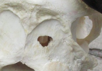 Blue Wildebeest Skull with 22 inch wide horns - $90